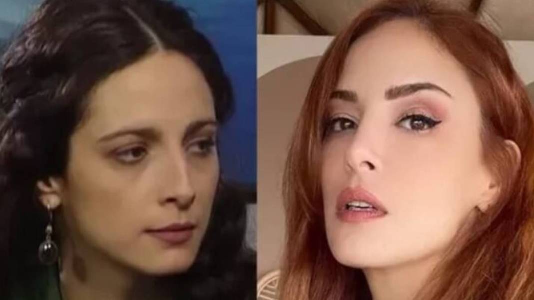 İşte estetikli ünlülerin listesi! Listeyi görünce 'yok artık onda da mı var?' diyeceksiniz 7